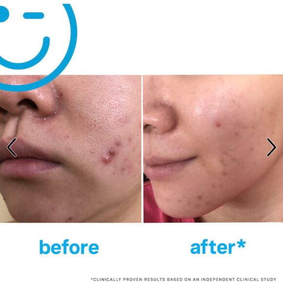 NIB Kate Somerville EradiKate™ 3% Sulfur Daily Foaming Cleanser + Acne Treatment - Picture 3 of 4